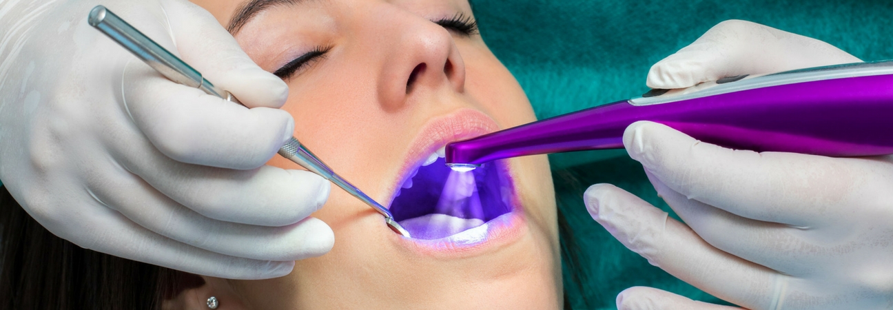 dentist applying dental selants to a child's teeth with a purple light